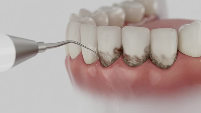 Trusted Teeth Cleaning And Checkup service in Helena West Side, MT - Dentist Open Now